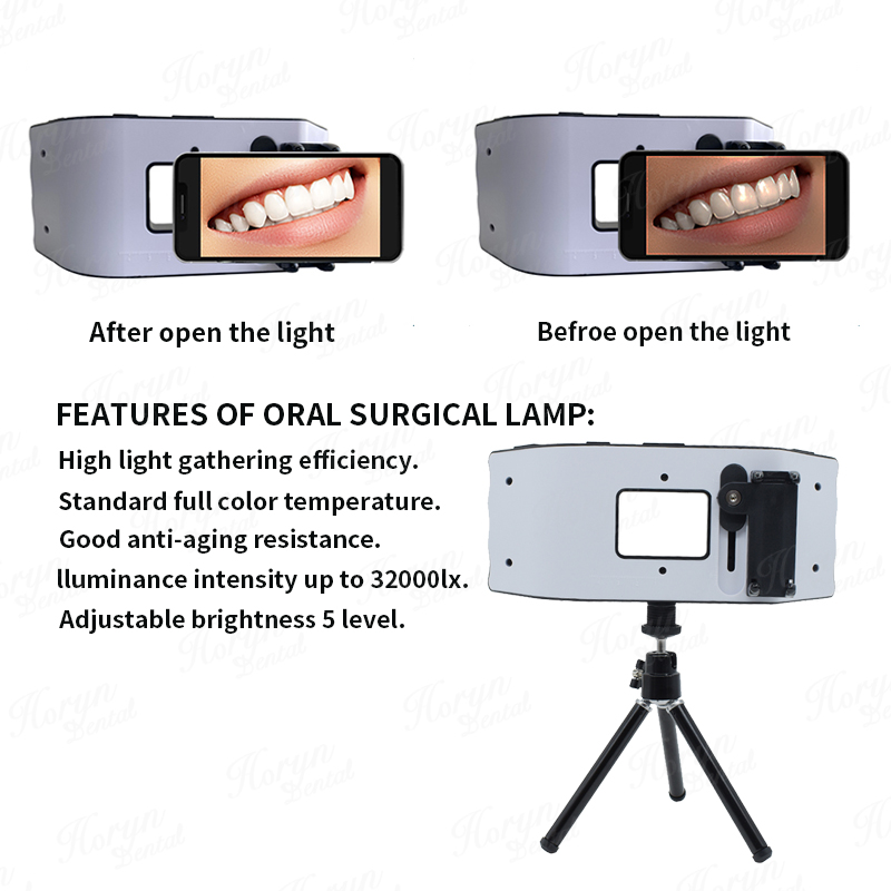 歯科用フラッシュライト,歯科医の写真機器,LED口腔充填ライ - Photography Lighting Led のレビューと価格